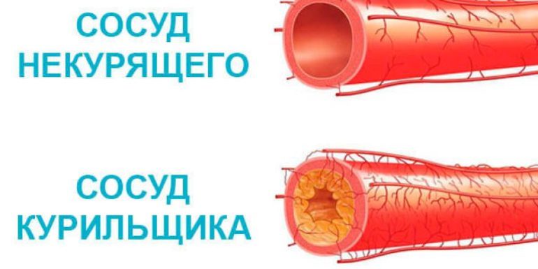 Регулярное курение приводит к сужению кровеносных сосудов. 